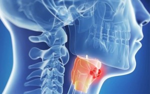 cancer-cabeza-cuello