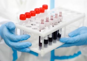 analisis sangre
