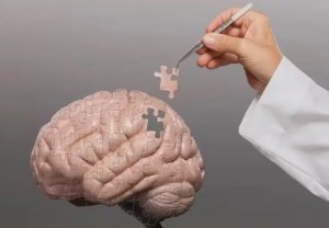 cerebro