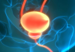 tumor vejiga
