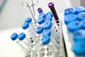 Descubren-que-factores-hacen-progresar-al-cancer-de-mama-triple-negativo