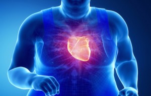 Obesidad y salud cardiovascular