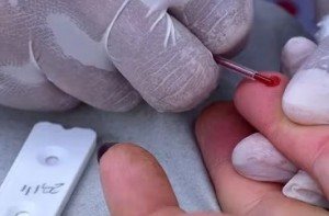 test hiv